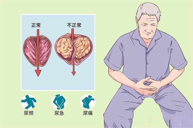 佛山激光碎石费用大概多少钱?